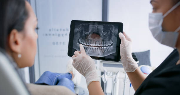 Licensed Wisdom Tooth Removal service in West Livingston, TX - Dentist Open Now